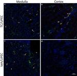 CD140b (PDGFRB) Antibody in Immunohistochemistry (IHC)