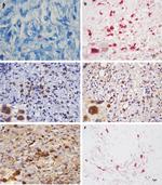 FOXP3 Antibody in Immunohistochemistry (IHC)