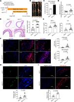 Galectin 3 Antibody in Immunohistochemistry, Immunocytochemistry (IHC, ICC/IF)