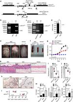 Ki-67 Antibody in Immunohistochemistry (IHC)