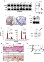 Ki-67 Antibody in Immunohistochemistry (IHC)