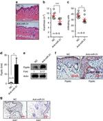 Ki-67 Antibody in Immunohistochemistry (IHC)