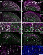 PAX2 Antibody in Immunohistochemistry (IHC)