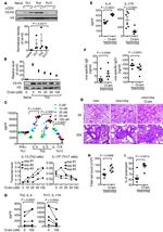 IL-17A Monoclonal Antibody (eBio64DEC17), eBioscience™