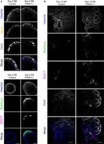 Nestin Antibody in Immunohistochemistry (Frozen), Immunocytochemistry (IHC (F), ICC/IF)