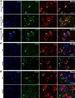 GFAP Antibody in Immunohistochemistry (IHC)