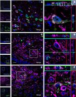 HuC/HuD Antibody in Immunocytochemistry (ICC/IF)