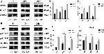 Phospho-PI3K p85 alpha (Tyr607) Antibody in Western Blot (WB)