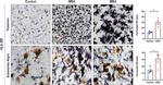 HLA-DR Antibody in Immunohistochemistry (IHC)
