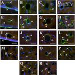 Beclin 1 Antibody in Immunohistochemistry (IHC)