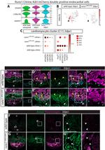Annexin A2 Antibody in Immunohistochemistry (IHC)