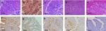 MMP2 Antibody in Immunohistochemistry (IHC)