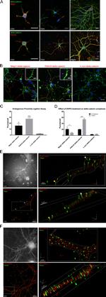 PDLIM5 Antibody in Immunocytochemistry (ICC/IF)