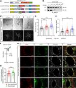 Versican V0, V1 Neo Antibody in Immunohistochemistry (PFA fixed), Immunocytochemistry (IHC (PFA), ICC/IF)