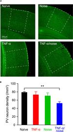 Parvalbumin Antibody in Immunohistochemistry, Immunocytochemistry (IHC, ICC/IF)