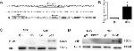NFkB p65 Antibody in Immunoprecipitation (IP)