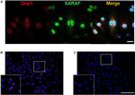 TMEM66 Antibody in Immunocytochemistry, Proximity Ligation Assay (PLA) (ICC/IF, PLA)