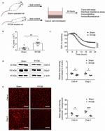 Desmoglein 2 Antibody in Western Blot, Immunocytochemistry (WB, ICC/IF)