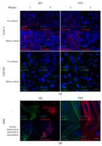 Vimentin Antibody in Immunocytochemistry (ICC/IF)