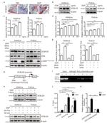 DCBLD2 Antibody in Western Blot (WB)