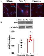 Calcium Sensing Receptor Antibody in Immunocytochemistry (ICC/IF)