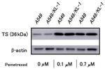 Thymidylate Synthase Antibody in Western Blot (WB)