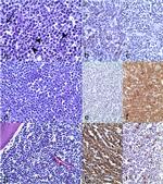 CD20 Antibody in Immunohistochemistry (IHC)