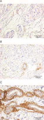 Fibulin 2 Antibody in Immunohistochemistry (IHC)