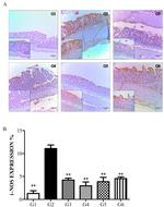 iNOS Antibody in Immunohistochemistry (IHC)