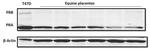 Progesterone Receptor Antibody in Western Blot (WB)
