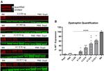 Sarcomeric alpha Actinin Antibody in Western Blot (WB)