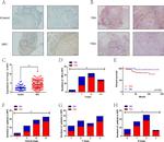 FOXQ1 Antibody in Immunohistochemistry (IHC)
