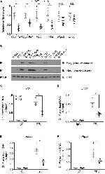 Estrogen Receptor beta Antibody in Immunoprecipitation (IP)