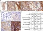 Ephrin A5 Antibody in Immunohistochemistry (IHC)