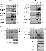 IGF1R alpha Antibody in Immunoprecipitation (IP)