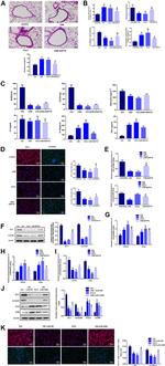 ZO-1 Antibody in Western Blot, Immunohistochemistry, Immunocytochemistry (WB, IHC, ICC/IF)
