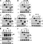 MARCH8 Antibody in Western Blot (WB)