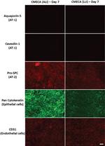 Aquaporin 5 Antibody in Immunocytochemistry (ICC/IF)