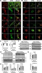 Parkin Antibody in Immunocytochemistry (ICC/IF)