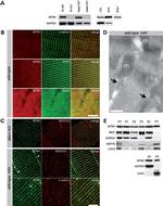 SERCA1 ATPase Antibody in Immunohistochemistry (IHC)