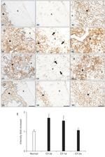Cytokeratin 5 Antibody