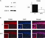 OxPhos Complex IV subunit IV Antibody in Western Blot (WB)