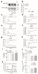 Adenylate Cyclase 8 Antibody