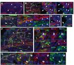 CD166 (ALCAM) Antibody in Immunohistochemistry (IHC)