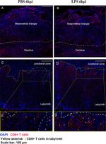 CD8 alpha Antibody in Immunohistochemistry (Frozen) (IHC (F))