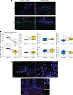 CD69 Monoclonal Antibody (FN50), eBioscience™
