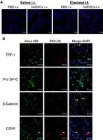CD324 (E-Cadherin) Antibody in Immunohistochemistry, Immunocytochemistry (IHC, ICC/IF)