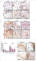 FOXP3 Antibody in Immunohistochemistry (Paraffin) (IHC (P))