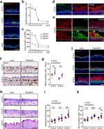 Plexin-B2 Antibody in Immunohistochemistry, Immunocytochemistry (IHC, ICC/IF)