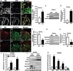 VEGF Receptor 3 Monoclonal Antibody (AFL4), Biotin, eBioscience™
